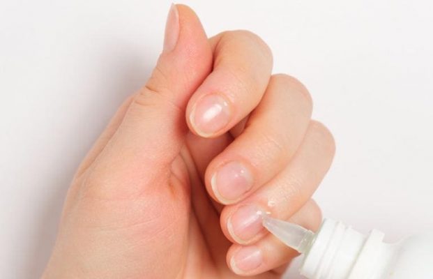簡単セルフ育爪の方法