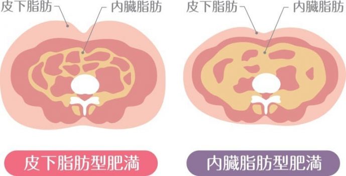 皮下脂肪と内臓脂肪