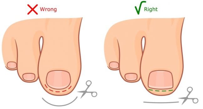 爪の正しいカットの方法