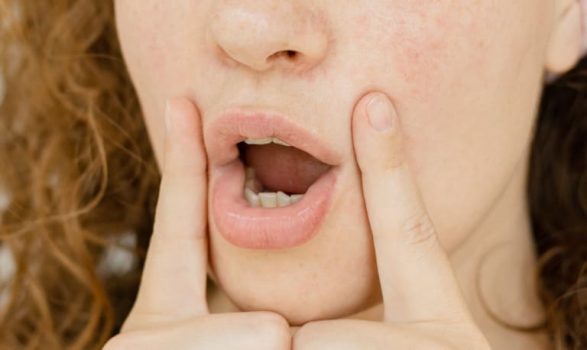 ほうれい線の原因と予防改善対策