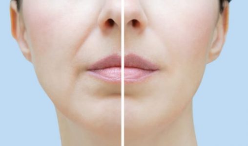 ほうれい線のケア方法