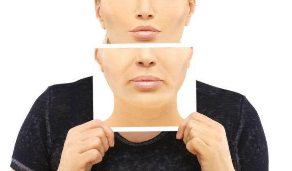 マリオネットラインの原因とケア方法