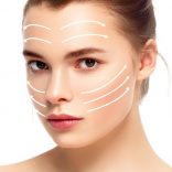 顔のリフトアップ