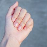 ハイポニキウム