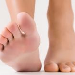 巻き爪の原因と対策！靴や歩き方に注意すべき理由とは
