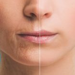 口元のシワ対策！シワの原因と予防方法まとめ