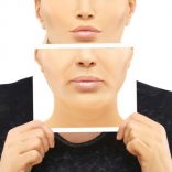 マリオネットラインの原因とケア方法